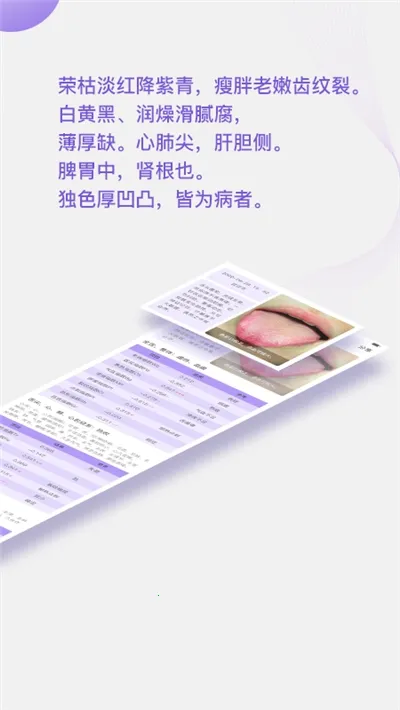 ����ͷ2026���ذ�װv3.3.18 �ֻ���