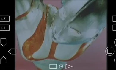 ��������������v3.3.2 ��׿��